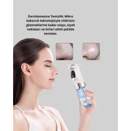 Evde Kolay Kullanım İçin Şarjlı Siyah Nokta Temizleme Aleti