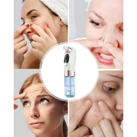 Titreşimli Elektrikli Gözenek Açıcı – Siyah Nokta Ve Yağ Arındırıcı